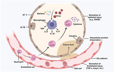Advanced development and mechanism of sepsis-related acute respiratory distress syndrome